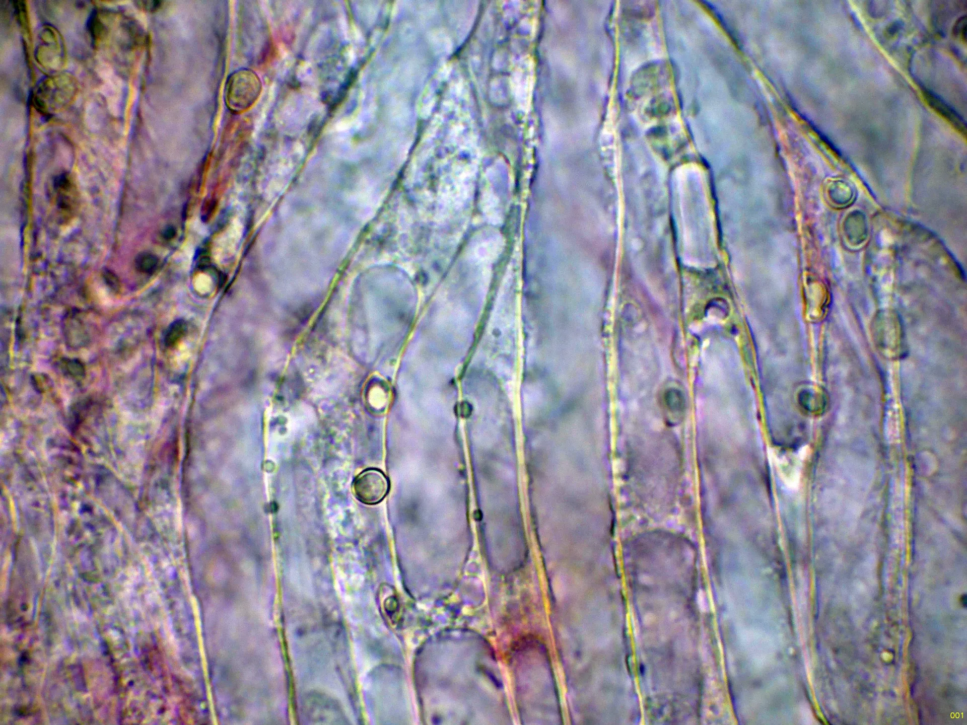 Microscopía de Pluteus petasatus - 10 - Trama laminar-001